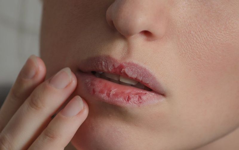 Simptoma të çuditshme që mund të tregojnë mungesë hekuri!