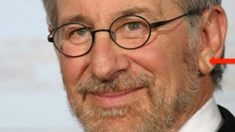 A rrezikoheni nga sulmi në tru? Mësoni nëse keni shenjën e Frankut