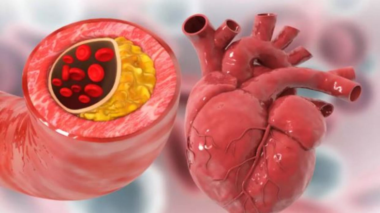 Shëndeti i zemrës/ 7 këshillat kryesore për të zhbllokuar arteriet në mënyrë natyrale dhe për të parandaluar goditjen në tru