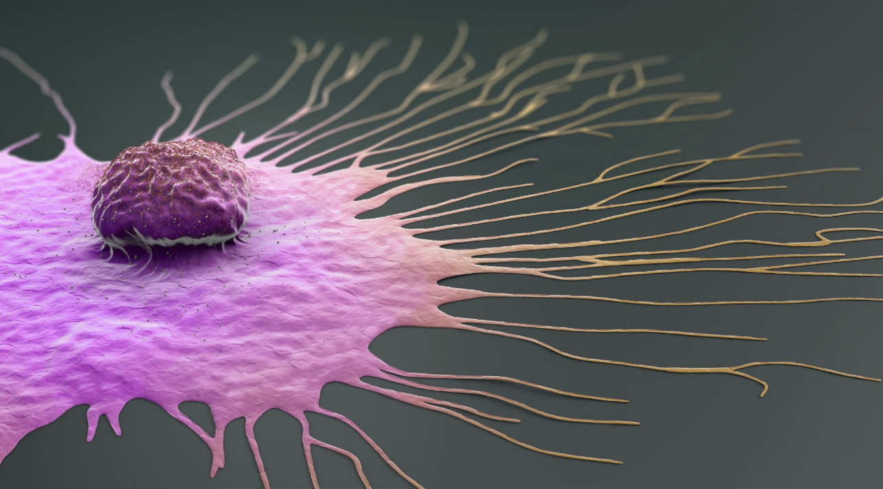 Zbulim/Shkaku i vërtetë që kanceri përhapet nëpër trup!