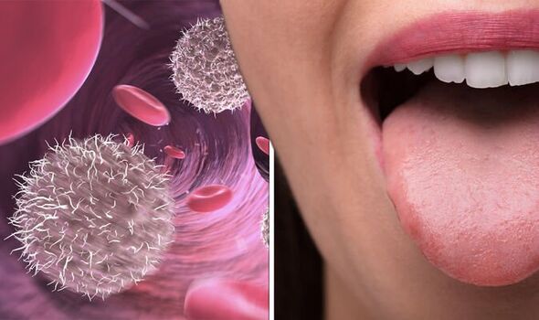 Një bakter në gojën tonë mund të kurojë kancerin?