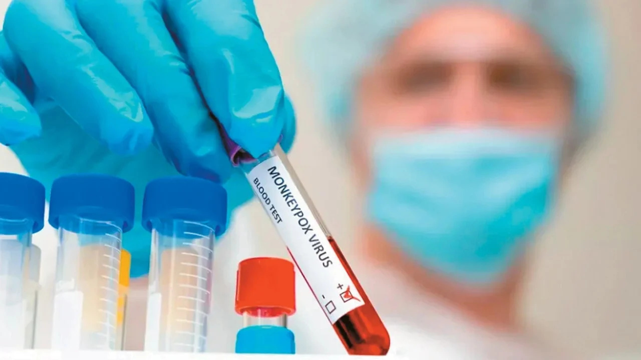 Europa në gatishmëri për sulmin e ri të lisë së majmunit! Përhapet përmes kontakteve seksuale dhe… Ja simptomat