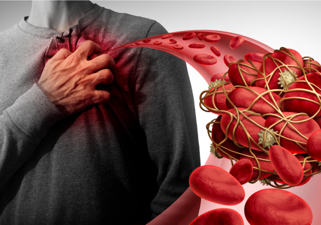 Para se të jetë vonë, zbuloni pesë shenja paralajmëruese të një ataku të heshtur në zemër gjatë natës