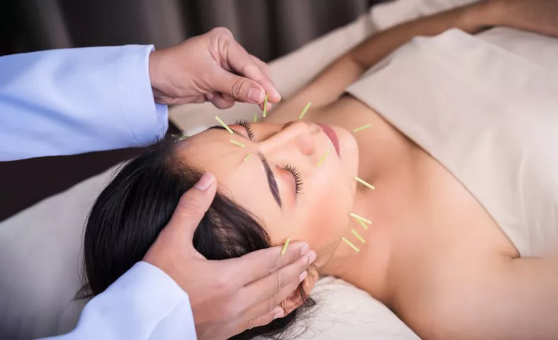 A mund të ndihmojë akupunktura te depresioni?