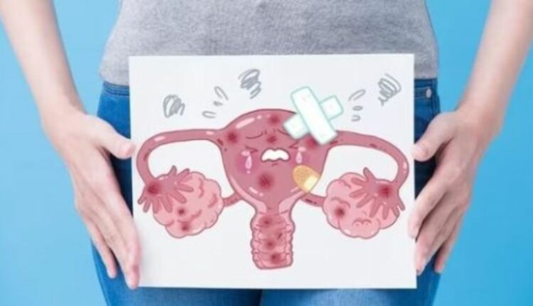 13 në 100 mijë gra preken nga kanceri i mitrës