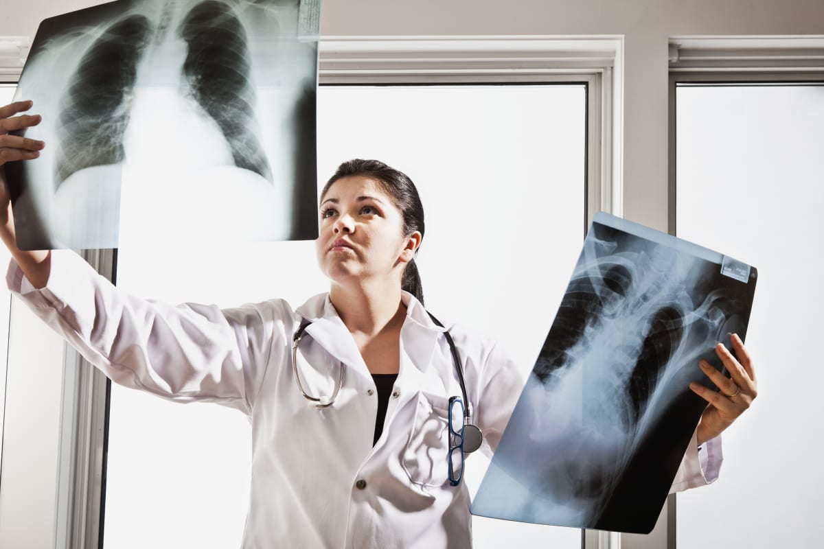 OBSH: Trendi shqetësues, rritja e numrit të pacientëve me kancer të mushkërive tek jo duhanpirësit