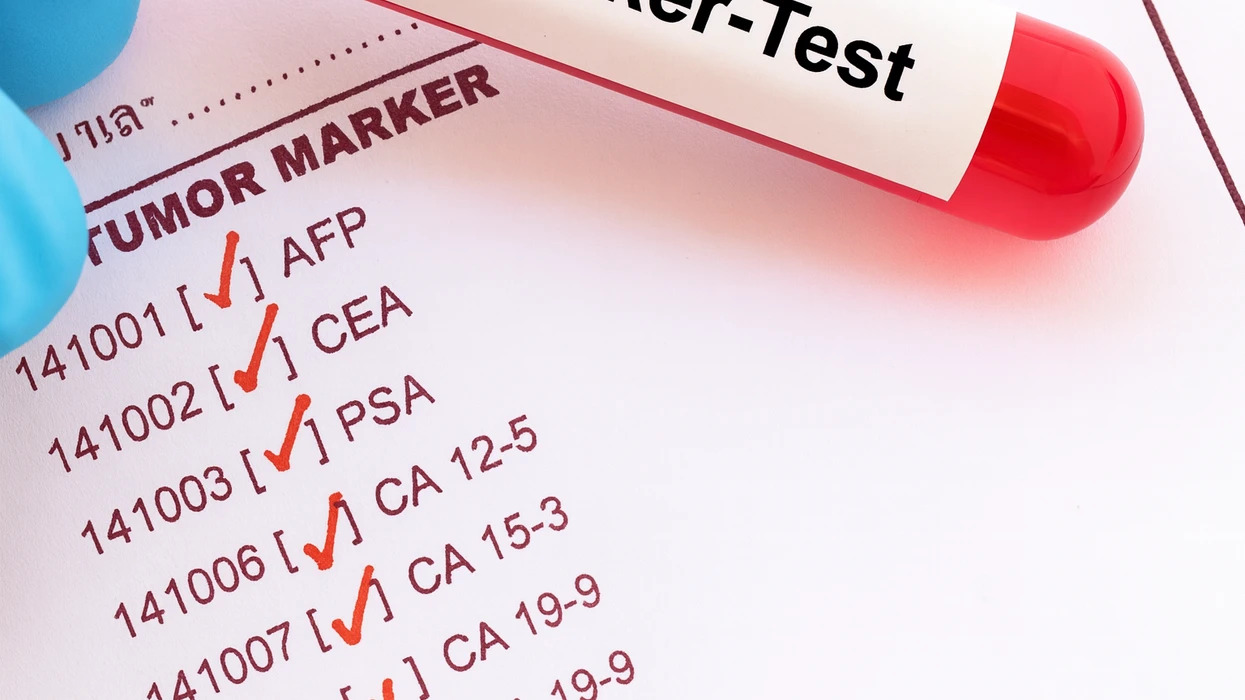 Kur dhe cilët tumor markerë përdoren më shpesh dhe sa të besueshme janë këto teste