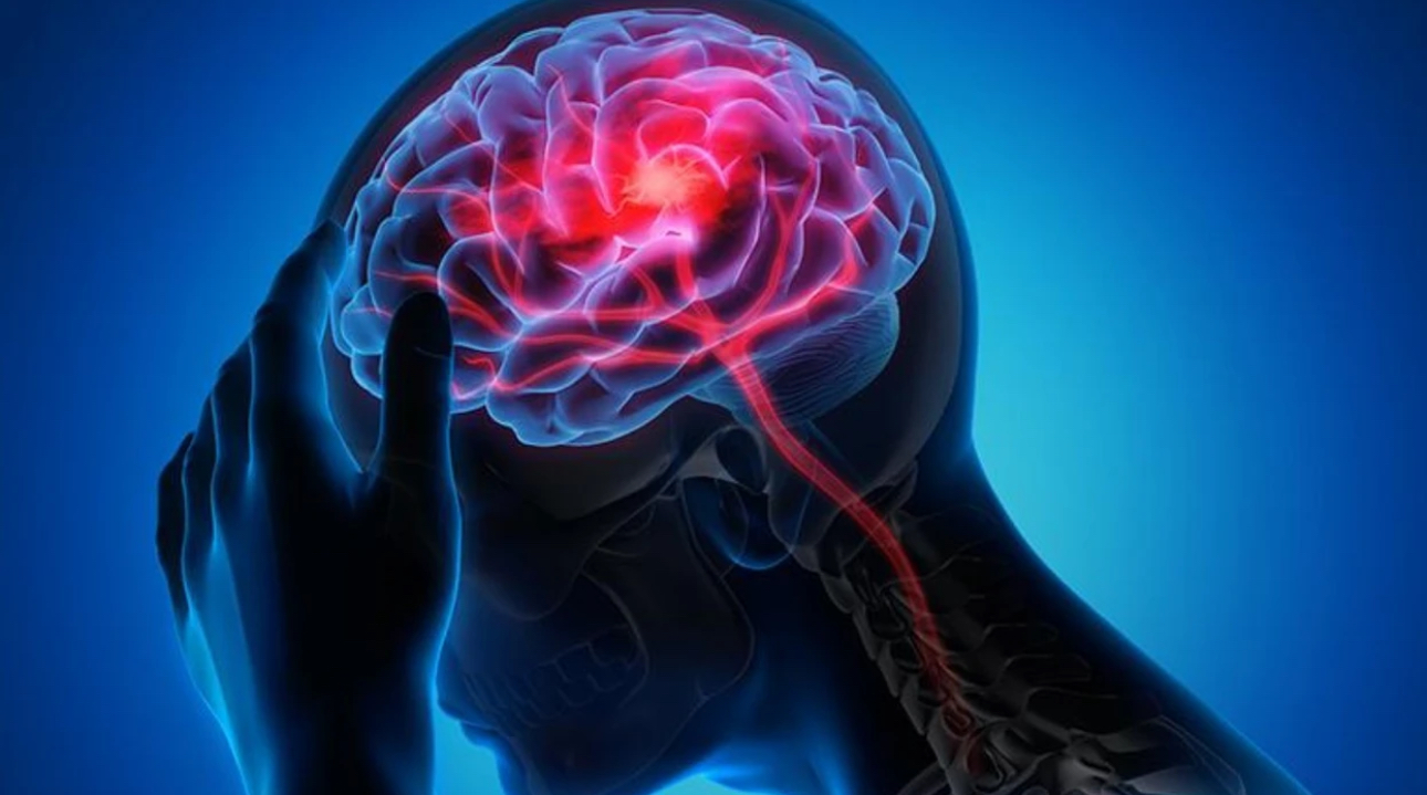 Lidhja mes grupit të gjakut dhe goditjes në tru tek të moshuarit