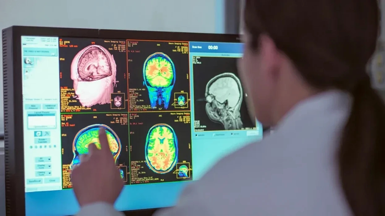 Adoleshenca e trurit zgjat deri në të 30-tat, ndryshe siç është menduar – thotë një studim i ri