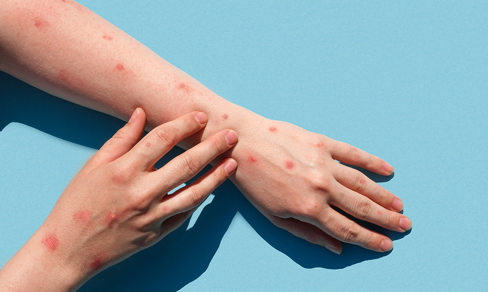 Kruarje, djersitje dhe lodhje - sëmundje e rrallë e gjakut që kërkon trajtim të hershëm dhe terapi inovative