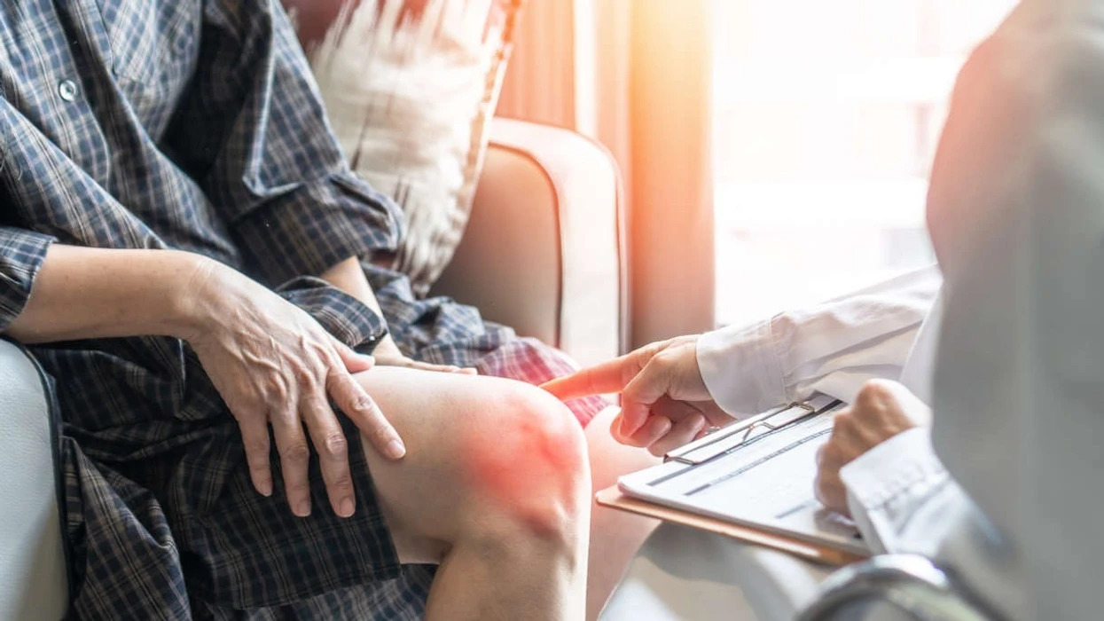 Cilat analiza të gjakut mund të konfirmojnë dyshimin për artrit reumatoid