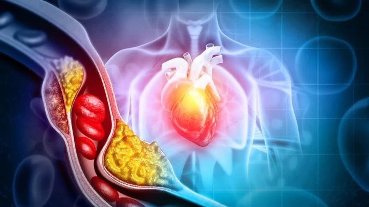 Pse edhe njerëzit e dobët kanë kolesterol të lartë? Shkaku që shumica nuk e dinë