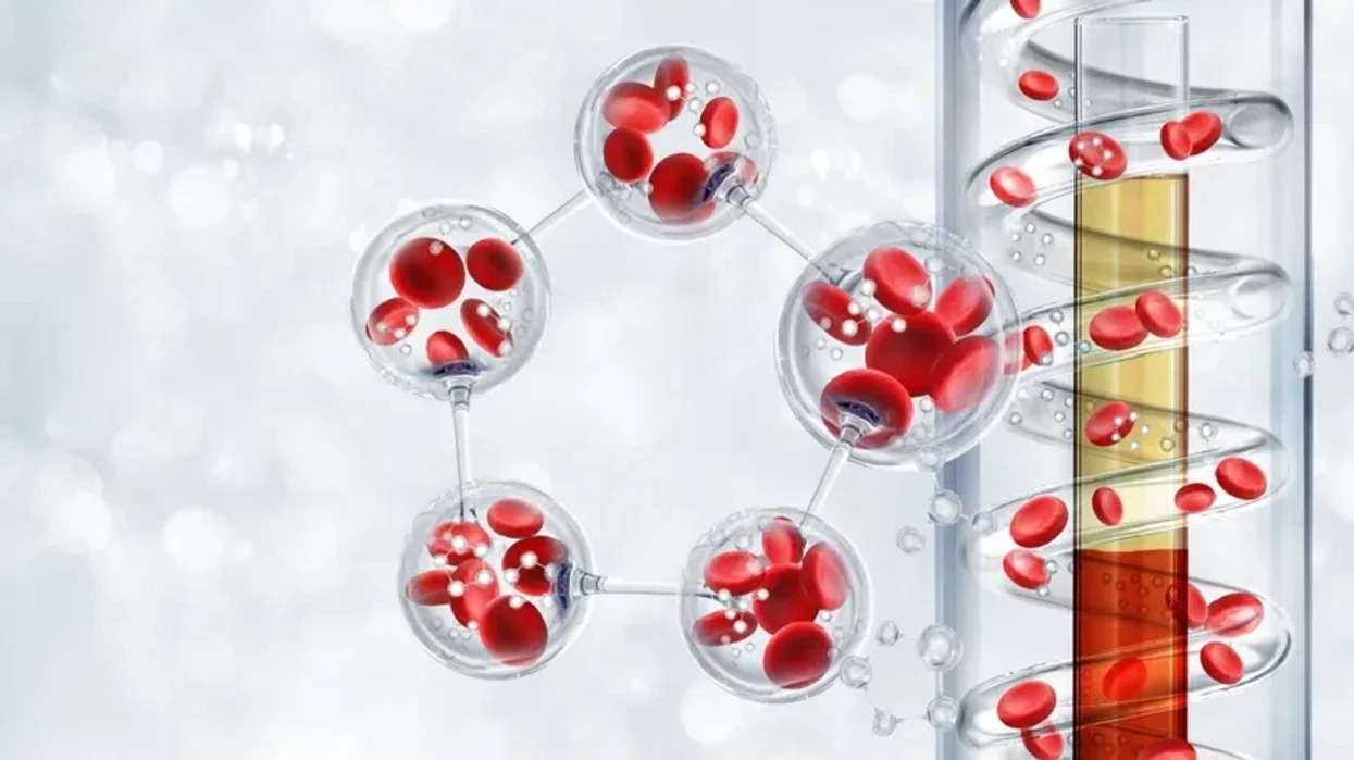 Analizat e gjakut mund të parashikojnë rrezikun e diabetit të tipit 2 vite përpara