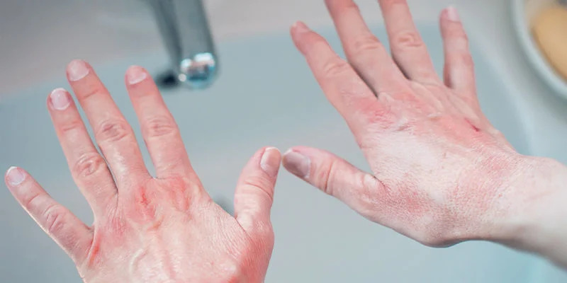 Duart e thata: Një truk menjëherë pas larjes parandalon tharjen