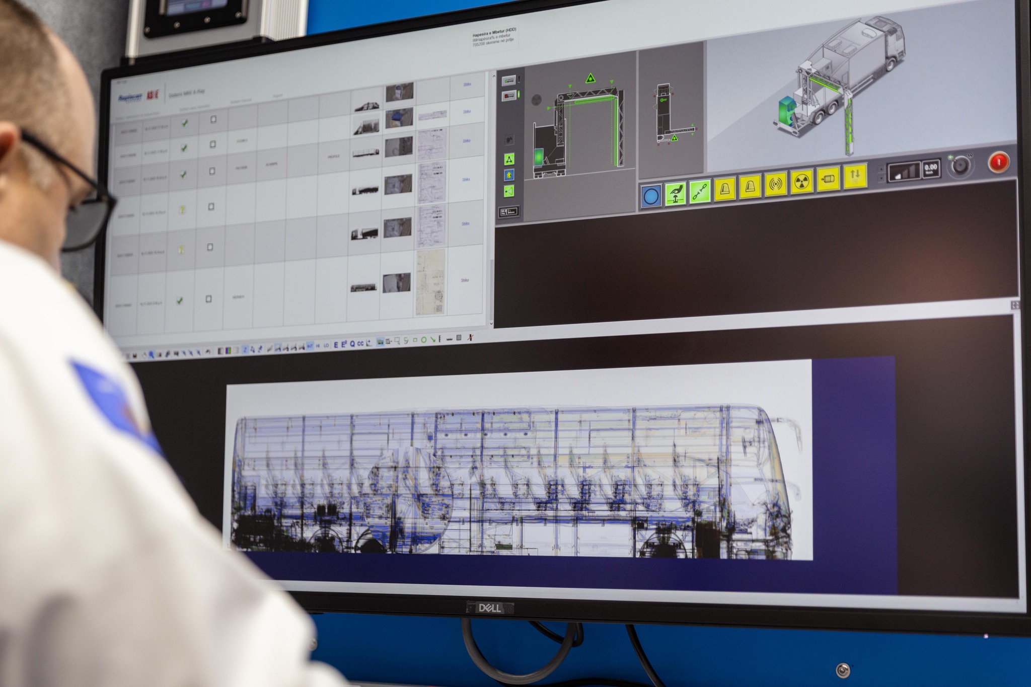 Vetëm një muaj pas dhurimit, skaneri 3-milionësh i SHBA-ve jep rezultatin e parë të madh